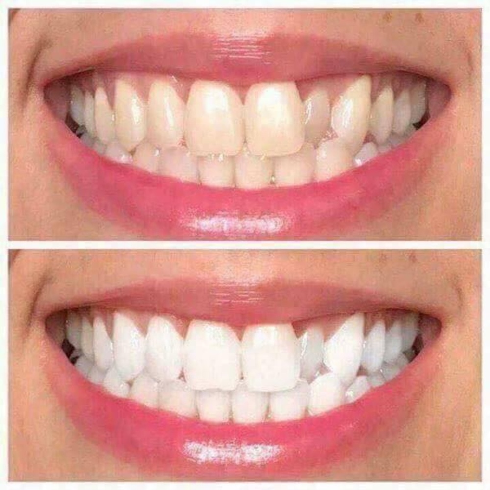 WHITENING TOOTHPASTE THAT WoRkS